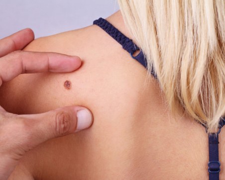 Скъсана бенка - какво трябва да направим веднага