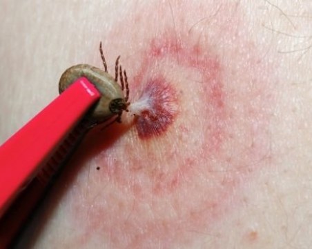 Забит кърлеж не се маже с олио и не се върти наляво или надясно