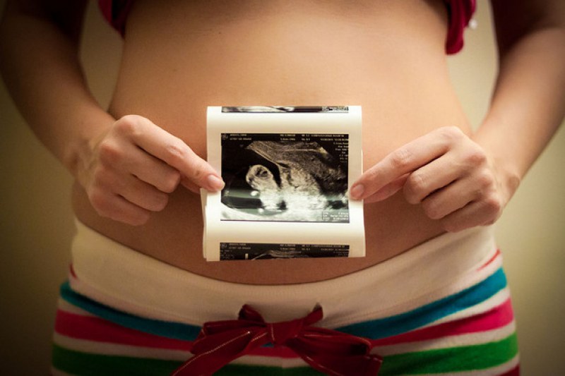 54 тийнейджърки от Пловдив и областта са направили аборт за три месеца