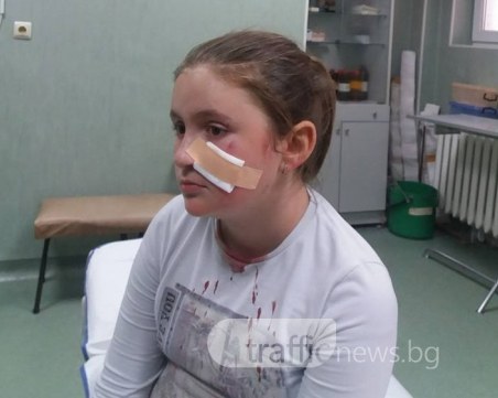 Майка: Обезобразиха лицето на дъщеря ми в час по физическо СНИМКИ