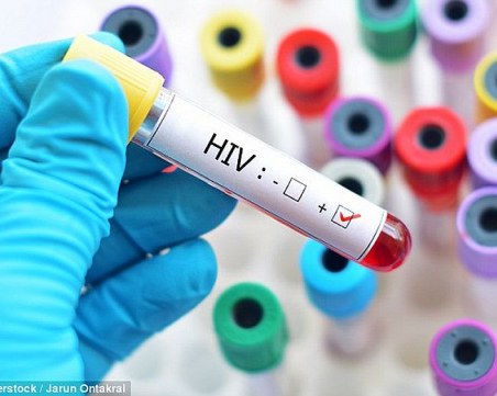 Всеки трети с ХИВ у нас е под 30 години