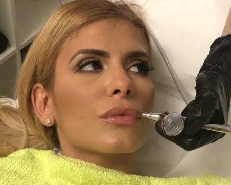 Анелия коригира устните си, феновете недоволстват СНИМКИ