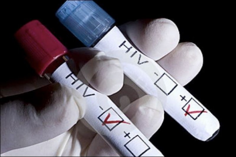 Само за 4 месеца: Нови 95 случая на ХИВ-серопозитивни