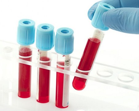 Научен пробив! Кръвен тест открива 10 типа рак
