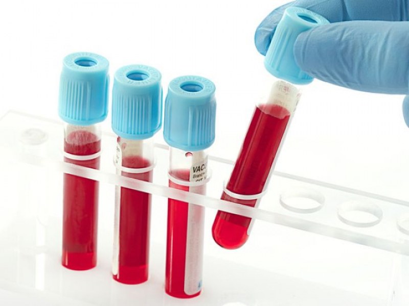 Научен пробив! Кръвен тест открива 10 типа рак