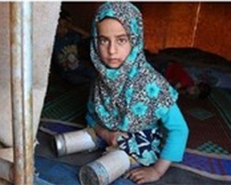 Сирийско момиченце с протези, изработени от консерви, разчувства хиляди по света