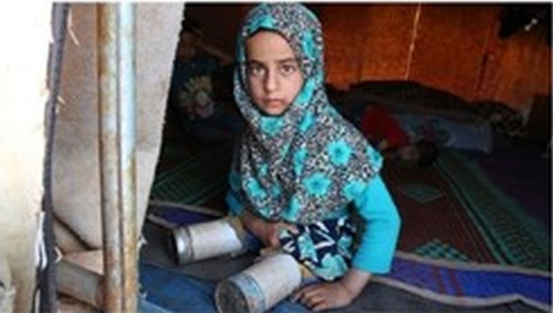 Сирийско момиченце с протези, изработени от консерви, разчувства хиляди по света