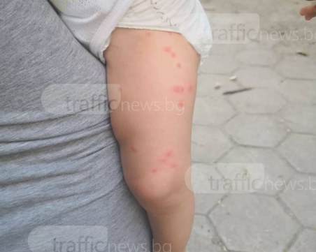 Бълхи полазиха детска площадка в центъра на Пловдив! Нахапаха зверски бебе СНИМКИ