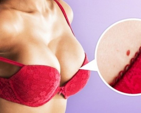 Как да махнем червените бенки по тялото си?