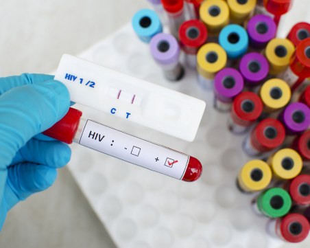 Учени обявиха напредък в създаването на ваксина срещу ХИВ