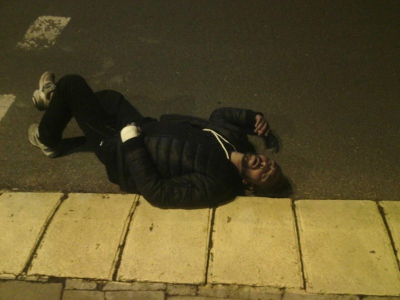 Внимавайте: Ром лежи на пътя в центъра на Пловдив! Оказа се, че симулира побой СНИМКА