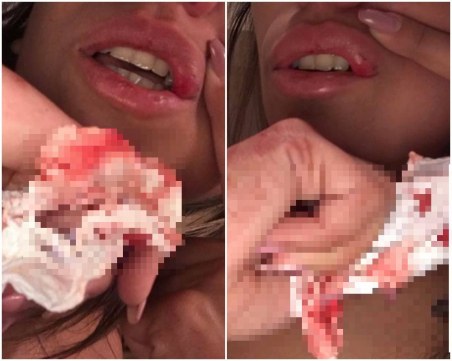 Красавицата Инес твърди, че е пребита от “бургаски батка“ в заведение СНИМКИ