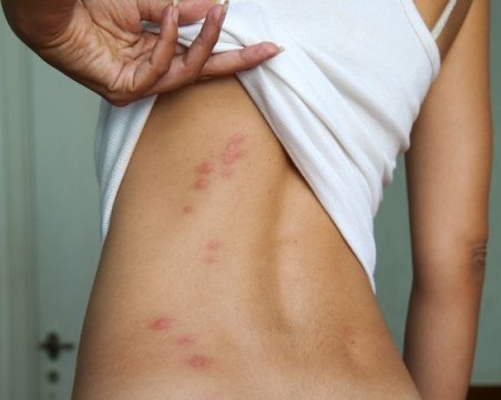 Защо комарите хапят някои хора повече от други?