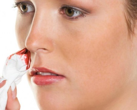 Какво да правим при кървене от носа?