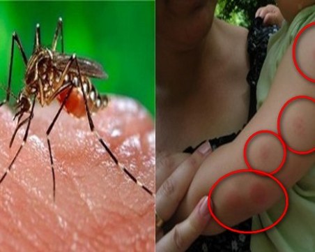 Девет души починаха в Сърбия от западнонилска треска