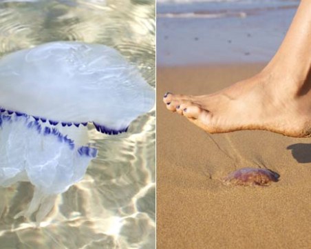 Какво да направите, ако ви опари медуза?