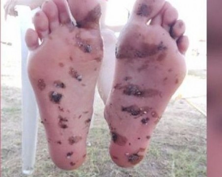 Отново мазут на плажа по курортите ни по Южното Черноморие СНИМКИ