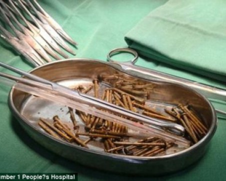 Млад мъж погълна 87 пирона след скандал с приятелката си СНИМКИ