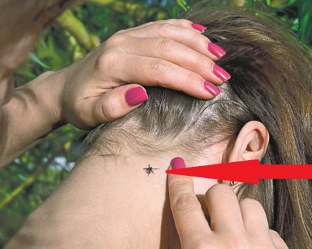 Специалист: Не вадете кърлежа сами