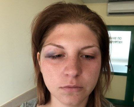 Семейни войни край Пловдив! Жена се жалва, че мъжът й я бие, той твърди, че тя кръшка СНИМКИ