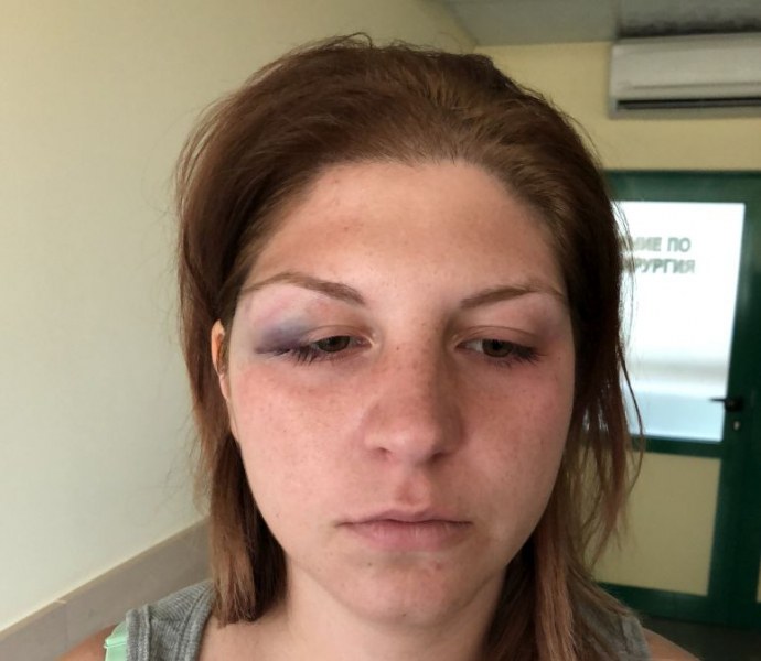Семейни войни край Пловдив! Жена се жалва, че мъжът й я бие, той твърди, че тя кръшка СНИМКИ
