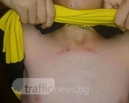 Пловдивчанин: Синът ми бе пребит от баща на друго дете! Обвиненият отрича ВИДЕО