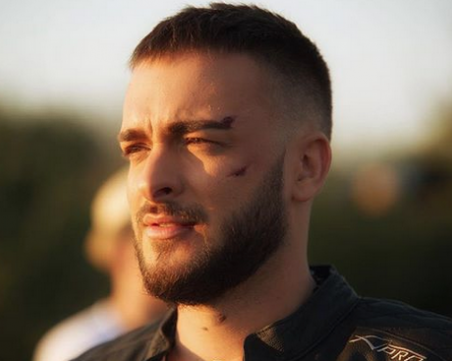 Криско падна от мотор! Показа си раните в Инстаграм СНИМКА