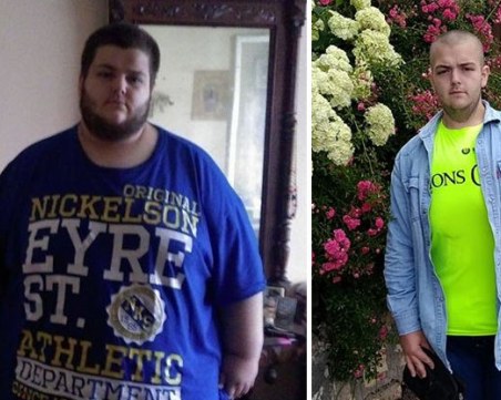 Пловдивчанин помогна на 300-килограмово момче да отслабне наполовина само за година