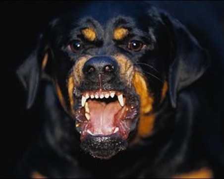 Жена беше жестоко нахапана от агресивен ротвайлер без намордник СНИМКА