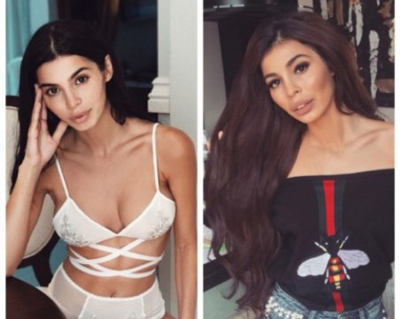 Мегз премахнала всички импланти от лицето си в турска клиника СНИМКИ