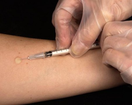 Създават ваксина, която ще сложи край на анорексията