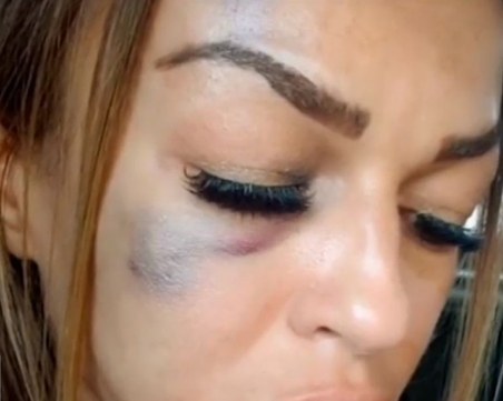 Жена твърди, че е била пребита от полицай след спор между децата им ВИДЕО