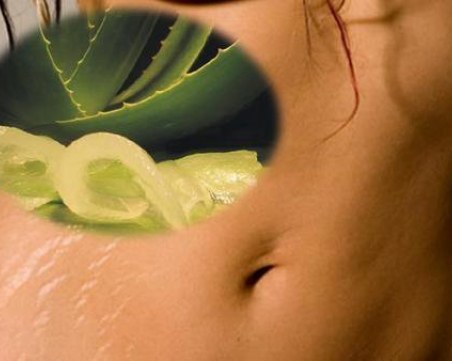 7 начина да се отървете от стриите