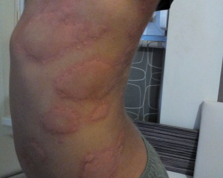 Пловдивчанка се оплака от пловдивски полицай, синът й с натряване след почерпка с кебапчета