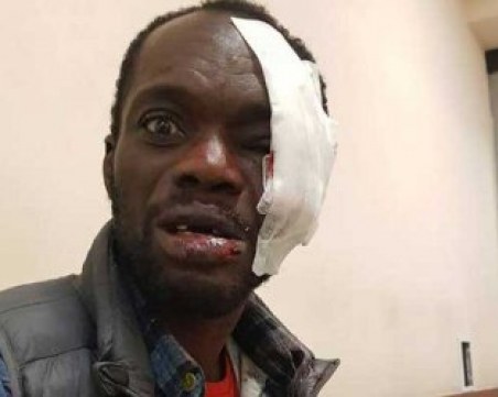 МВР мълчи за побой на чернокож на метри от главния вход на ведомството! Защо?