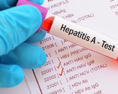 Откриха хепатит А в над 20 училища и детски градини