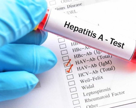 Родители се оплакаха от прикриване на случай на хепатит А в училище