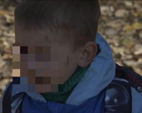 Агресия сред децата и в градините! 3-годишно дете бе издранo от свой връстник