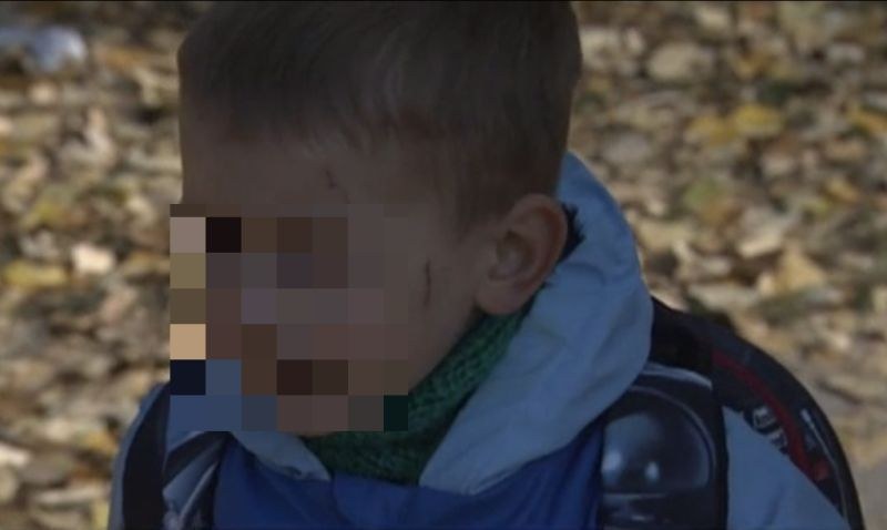 Агресия сред децата и в градините! 3-годишно дете бе издранo от свой връстник
