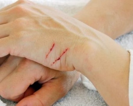 Мъж наряза ръцете на жена си след скандал
