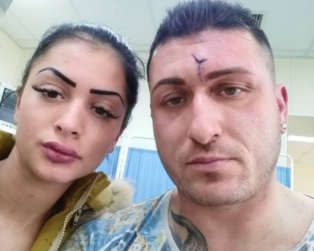 Отново агресия на пътя: Пребиха шофьор и приятелката му във Варна