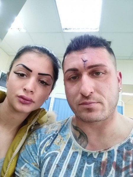 Отново агресия на пътя: Пребиха шофьор и приятелката му във Варна
