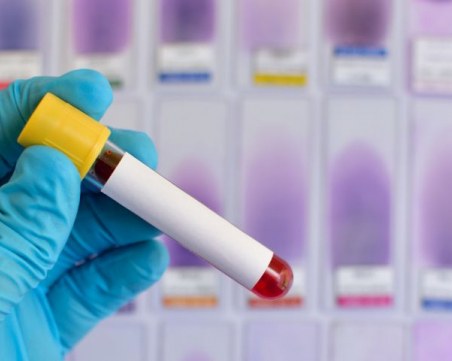 Пробив! Кръвен тест открива Алцхаймер 10 години преди симптомите