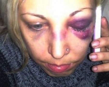 Съдебно възмездие за Добринка и Димитър, бити от полицай в метрото