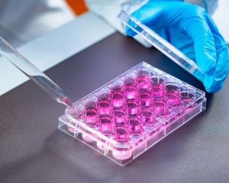 Болните от морбили вече са 17! Най-малкото – дете на 5 месеца