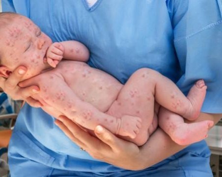 Пловдивчанин изригна срещу антиваксърите с: 