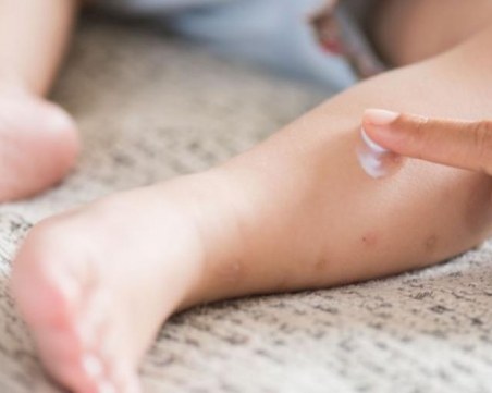 4-месечно бебе е със съмнение за морбили, преместиха го в инфекциозно отделение