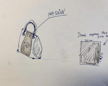 Британка дава 3000 паунда: От ампутирания ми крак искам чанта!