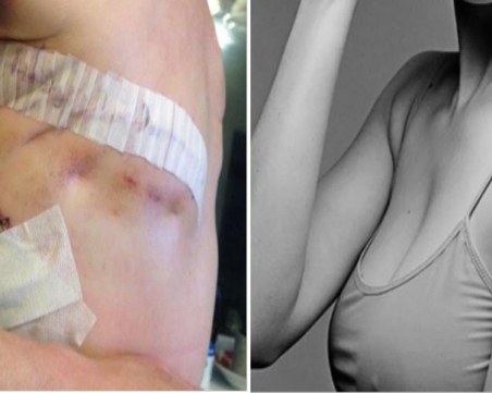 Черно-бял ли е ракът, или новото предизвикателство във Фейсбук е само поза?