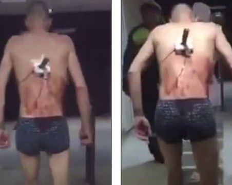 Руска му работа: Мъж с нож в гърба излезе от болницата, за да пуши ВИДЕО